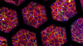 Eingefärbte Patientenzellen, die auf einer „Lunge auf Chip“ der zweiten Generation kultiviert wurden.  (© Pauline Zamprogno, ARTORG Center for Biological Engineering Research )