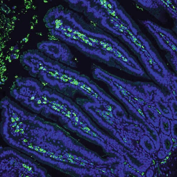 Dünndarmschleimhaut von keimfreien Mäusen mit IgA-produzierenden Plasmazellen (grün).   (Brigham & Women’s Hospital, Harvard Medical School )