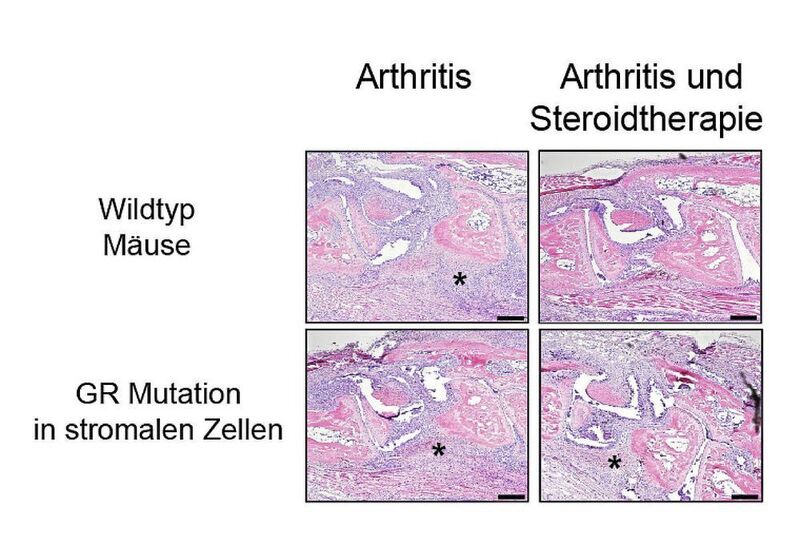 Histologische Untersuchungen von arthritischen Wildtyp-Mäusen (obere Reihe) und Mäusen mit einer Mutation des Cortisonrezeptors (GR) in nicht-Immunzellen. In arthritischen Mäusen (links) zeigen Wildtyp- und mutante Mäuse starke Einwanderungen von entzündlichen Zellen im Gelenk (Sternchen). Bei der Steroidtherapie (rechts) verschwinden die Entzündungszellen in Wildtyp Mäusen, aber nicht bei den mutanten Mäusen (rechts) (Institut für Molekulare Endokrinologie der Tiere)