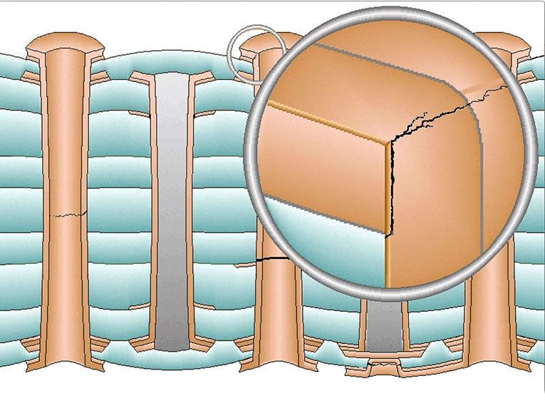 Corner Cracks entstehen an den geometrischen Übergängen der Kupfermetallisierung, etwa zwischen der Hülse einer Durchkontaktierung und dem äußeren Anschluss-Pad. Wiederholte thermische Ausdehnung belastet diese Ecke, bis das Kupfer ermüdet und ein Riss entsteht. (Bild: Polar Instruments)