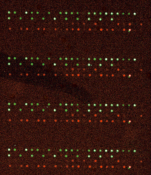 Abb.6: Typische Aufnahme eines Mikroarray (Archiv: Vogel Business Media)