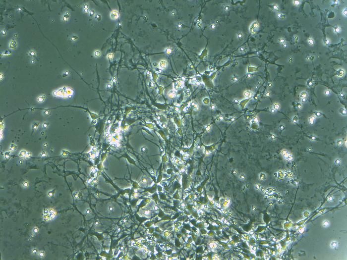 Autismus in der Petrischale Autismus-Spektrum-Störungen (ASD) sind komplexe neurologische Entwicklungsstörungen, die durch Schwierigkeiten in der sozialen Interaktion, Kommunikation und durch eingeschränkte, repetitive Verhaltensmuster gekennzeichnet sind. Obwohl die genauen Ursachen nicht vollständig verstanden sind, vermuten Wissenschaftler eine genetische Prädisposition Ein Forschungsteam der Kobe University hat 63 Maus-embryonale Stammzelllinien mit den Mutationen erstellt, die am stärksten mit Autismus assoziiert sind, um genetische Ursachen der Erkrankung zu untersuchen. Die Studie zeigte, dass diese Zellen Modellversuche zur Untersuchung von Autismus unterstützen und Gene identifizieren, die in bestimmten Zelltypen abnormal aktiv sind. Zudem fiel auf, dass autismusverursachende Mutationen oft dazu führen, dass Neuronen unförmige Proteine nicht beseitigen können, was möglicherweise neuronale Defekte verursacht. Diese Zellbank bietet wertvolle Ressourcen zur Erforschung von Autismus und verwandten psychischen Störungen wie Schizophrenie und Bipolarität. Das Bild zeigt das Zellmodell aus Neuronen, die aus menschlichen embryonalen Stammzellen hergestellt wurden. Das Modell ermöglichen das Studium, wie Veränderungen in den Genen die Form und Funktion der Zelle beeinflussen.   Hier gehts zur OriginalmeldungWissenschaftsbild des Tages vom 10.6.2025 Bildquelle: NOMURA Jun:  Zellmodell aus Neuronen,  Kobe University (CC BY 4.0)   (Bild: NOMURA Jun)
