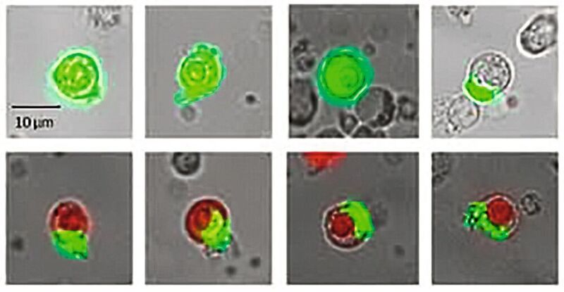 Abb. 2: Beispiele für lebende und tote Zellen aus einer Patientenprobe. Oben: Zellen  leuchten grün, wenn sie das EpCAM-Molekül tragen. Unten: Zellen, bei denen der Propidiumiodid-Farbstoff durch die beschädigte Kernhülle eindringen konnte und somit die abgestorbenen Zellen markiert. (Simfo)