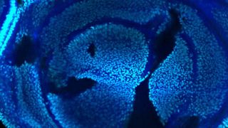 Flügel-Imaginalscheibe einer Taufliege: Die schwarzgefärbten Zellen können keine Histonmodifikation am Lysin vornehmen. Dennoch können sie sich teilen und Gene ablesen. Die dunkelblaue Färbung markiert die nicht-mutanten Zellen, Cyan markiert die Modifikation am Lysin. (Bild: UZH)