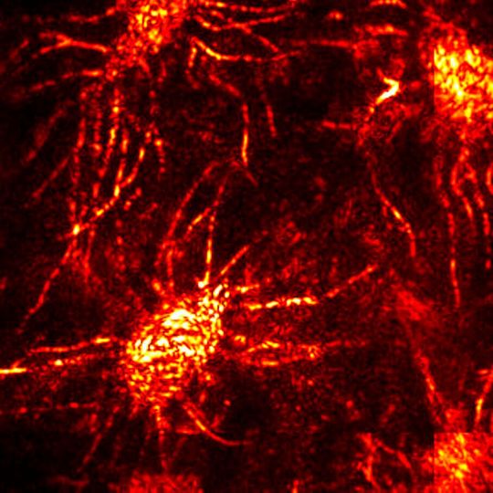 A neural network in the brain of a living mouse was observed without removing the skull. A neural network in the brain of a living mouse was observed without removing the skull.