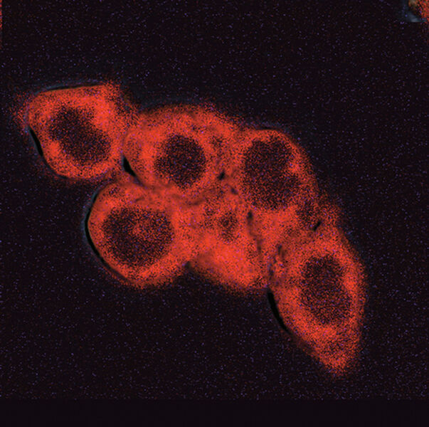Abb.3: Aufnahme der durch Silencing der Ferrochelatase induzierten PpIX-Fluoreszenz von Tumorzellen mithilfe der 2-Photonen-Mikroskopie. (Bild: MDC Berlin)