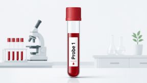 Per Blutprobe ermöglicht der NfL-Test von Roche den Nachweis von Neuroinflammation bei Multipler Sklerose – Symbolbild (Bild: GPT Image Editor / KI-generiert)