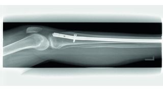 SMT entwickelt in Zusammenarbeit mit und für Kunden und Operateuren Instrumente, Implantate, Apparate und Sets für die Human- und Veterinärmedizin. (Bild: SMT)