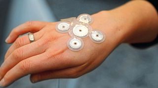 Mit solchen Elektroden sollen bald Epilepsie-Symptome behandelt werden. (Precisis)