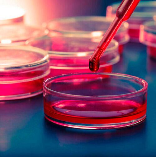 The finding opens the door for ACT to treat harder-to-reach cancer types and makes it a more viable option for hospitals. The finding opens the door for ACT to treat harder-to-reach cancer types and makes it a more viable option for hospitals.