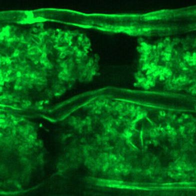 Arbuskuläre Mykorrhizastrukturen innerhalb der Wurzelrindenzellen von L. japonicus. (Bild: Kiran Raj, IPB, modifiziert von Raj et al. Science Advances)