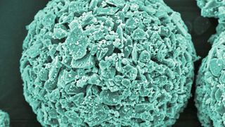 Empa-Forschende entwickeln neuartige Filtersysteme aus Kompositmaterialien. Im Bild: Keramikgranulat mit Kupfer-Nanobeschichtung. (Bild: Sena Yüzbasi / Empa)