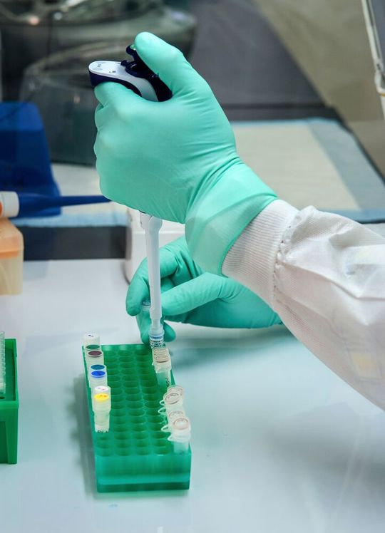 A new blood test can detect ‘toxic’ protein years before Alzheimer’s symptoms emerge, a study shows. A new blood test can detect ‘toxic’ protein years before Alzheimer’s symptoms emerge, a study shows.