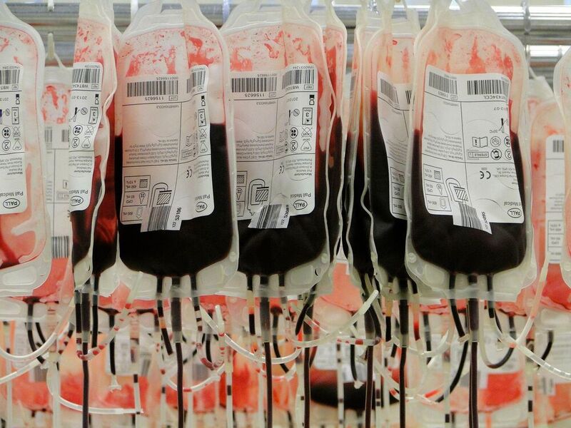 Mehr als 3,2 Mio. Blutkonserven pro Jahr werden hierzulande laut Barmer-Krankenhausreport 2019 eingesetzt. Damit benötigt Deutschland so viel Spenderblut pro Kopf wie kein anderes Land. (gemeinfrei)