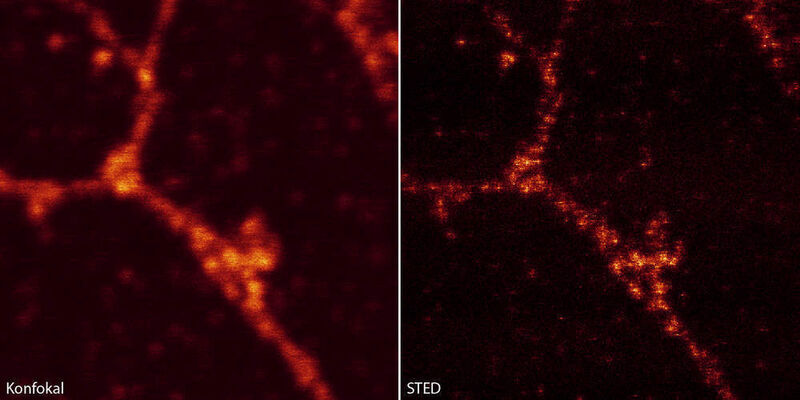 Die Bilder zeigen verschiedene Bereiche in Axonen von Neuronen in Zellkultur. Die Zellen stammen aus dem Hippocampus der Ratte (Rattus norvegicus). Das synaptische Protein Synaptotagmin 1 wurde mit einem primären monoklonalen Maus-Antikörper und mit einem sekundären Antikörper markiert, der den Fluoreszenzfarbstoff trägt (Atto 647N). Im STED-Modus sind die synaptischen Vesikel als einzelne Punkte deutlich zu erkennen (rechts), im Gegensatz zum Konfokalmodus (links). (Archiv: Vogel Business Media)