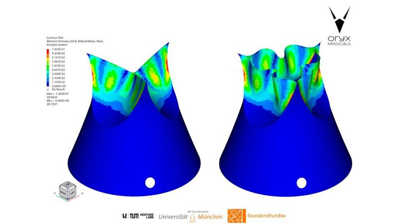 Die Klappe von Oryx Medicals kann mittels TAVI implantiert werden und bietet eine langlebige, minimalinvasive Option, die die Genesungszeit und das Komplikationsrisiko deutlich reduziert. Durch den Einsatz fortschrittlicher additiver Fertigungstechnologien sind die Klappen nicht nur langlebig, sondern auch patientenspezifisch. Jede Klappe wird auf die individuelle Anatomie des Patienten abgestimmt, was ihre Passform und Funktion verbessert und gleichzeitig mögliche Komplikationen wie Leckagen oder Thrombosen reduziert. Das maßgeschneiderte Design basiert auf medizinischen Bildgebungsdaten und ermöglicht eine präzise Anpassung an die einzigartige kardiovaskuläre Struktur jedes Patienten. (Bild: Oryx Medicals)