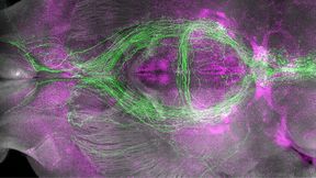 Schlaffördernde Neuronen (grün) und kürzlich aktivierte Neuronen (magenta) im Mausgehirn.  (Bild: William Joo, Biozentrum, Universität Basel)