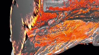 3D Lichtscheiben-Mikroskopie-Aufnahme: Werden Myelinscheiden im Rückenmark beschädigt, häufen sich Mikroglia und Makrophagen (orange) in diesen Problemzonen an, um das defekte Gewebe zu beseitigen. (© MPI für experimentelle Medizin/ Depp, Berghoff )