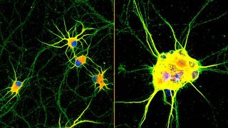 Fluorescent images of human neurons (stained with red, green and blue) growing on coatings with fast-moving molecules (left) or conventional laminin (right) for 60 days. Neurons spread homogenously and showed more complex branching on the highly mobile coating developed at Northwestern. (Source: Northwestern University)