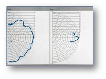 Das Antennendiagramm zeigt die Strahlungscharakteristik einer vermessenen Antenne. (Bild:  NOFFZ)