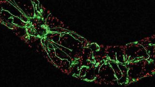 Pflanzen zeigen der Hitze den „Finger“: Geraten Pflanzen durch hohe Temperaturen oder Trockenheit in Stress, bilden sich im Innern der Zellen Ausstülpungen, die Schutzprogramme auslösen.  (Bild: Toranj Rahpeyma, KIT)