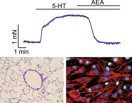 Oben die Kraftmessungen in den Bronchien. Nach der Gabe von Anandamid lässt die Spannung nach. Unten links ein histologischer Schnitt einer Mauslunge mit zentralem Bronchus und unten rechts menschliche bronchiale Muskelzellen mit roter Immunfärbung gegen FAAH, die Zellkerne sind blau gefärbt.(Bild:  © Annika Simon)