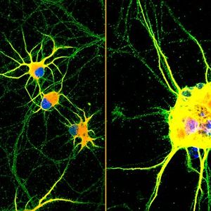 Fluorescent images of human neurons (stained with red, green and blue) growing on coatings with fast-moving molecules (left) or conventional laminin (right) for 60 days. Neurons spread homogenously and showed more complex branching on the highly mobile coating developed at Northwestern.(Source:  Northwestern University)
