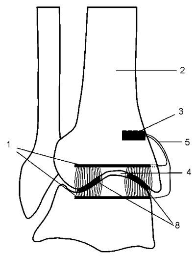 Implantatanordnung zur elektrischen Stimulation von Knorpelgewebe.