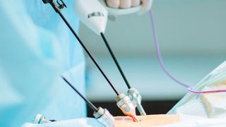 Covestro hat neue glasgefüllte Polycarbonate für Anwendungen entwickelt, die eine besondere Steifigkeit und Festigkeit erfordern, zum Beispiel laparoskopische chirurgische Instrumente. (Covestro)