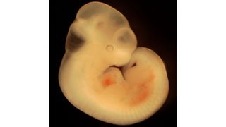 Forscher der Universität Bonn haben mit Kollegen aus Japan und den Niederlanden eine Methode entwickelt, mit der sich dieser Massen-Zelluntergang in Embryonen der Maus filmen lässt. (Symbolbild Mausembryo) (Natalia Sinjushina and Evgeniy Meyke)