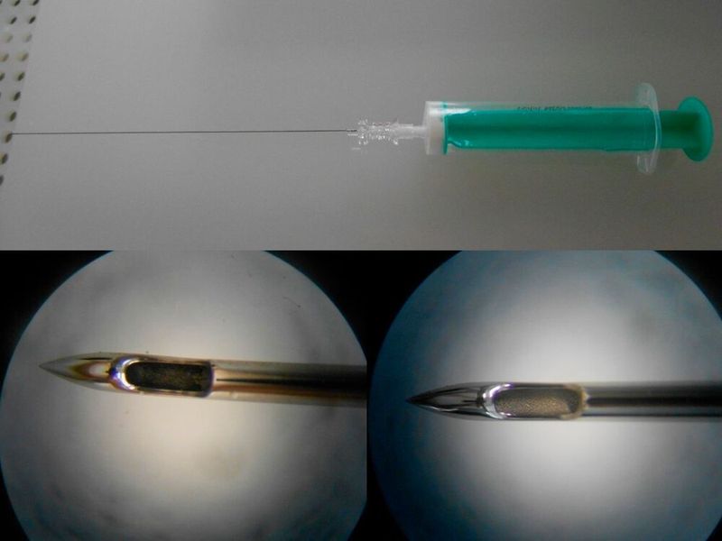 Das Verfahren zyklische Nukleation (CNp) ermöglicht, Verunreinigungen auch aus feinen Kapillaren wie bei dieser PDA-Kanüle sowie Lumenstrukturen geometrisch komplexer Bauteiler zu entfernen.  (LPW Reinigungssysteme)