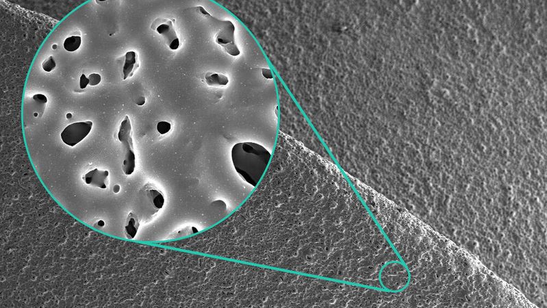 Scanning electron microscope image of a silver-doped porous micro-arc oxide layer on titanium.(Image: Fraunhofer IFAM)