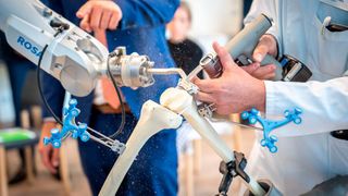 Der Roboter hilft, eine vorher am Computer angefertigte Operationsplanung exakt auf den Körper des Patienten zu übertragen. Er kontrolliert während des Eingriffs die Schnittebene auf den Millimeter genau.  (Bild: Dirk Pagels| Helios Kliniken )