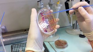 Abimpfung einzelner ESBL-E-Kolonien für die weitere Laboranalyse (Quelle: Universität Bonn, Ricarda Schmithausen)