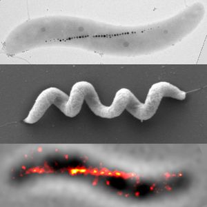 Magnetbakterium Magnetospirillum gryphiswaldense in verschiedenen mikroskopischen Aufnahmen