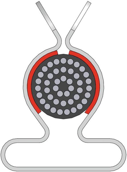 Bild 1: Vergleich der Schirmklammer SKL (links) mit herkömmlichen Federdruck-Schirmklemmen. (icotek)