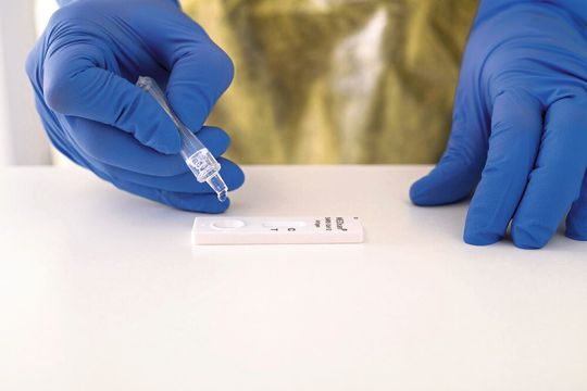 Mittels Dosierhilfe werden einige Tropfen des Patientenproben-Puffergemischs auf den Teststreifen gegeben. Durch die Pufferlösung wird das Virusprotein aus der Abstrichprobe herausgelöst und mehr oder weniger verlässlich angezeigt.(Bild:  Angie Wolf / UKW)