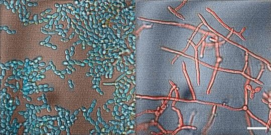 Candida albicans in seiner harmlosen (l.) und seiner infektiösen (r.) Form. Der weiße Balken entspricht 20 Mikrometern. Candida albicans in seiner harmlosen (l.) und seiner infektiösen (r.) Form. Der weiße Balken entspricht 20 Mikrometern.