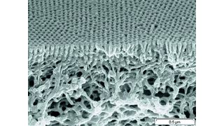 Abb. 1 Morphologie eines Multipfropfcopolymers (Kooperation Prof. Weidisch und Prof. Mays). (Archiv: Vogel Business Media)