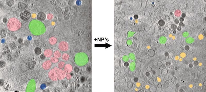 Nach Aufnahme von Nanopartikeln (rechtes Bild) gibt es in der Zelle weniger Lipidtröpfchen (blau) und multivesikuläre Körperchen (rosa) und dafür mehr Mitochondrien (grün) und Endosomen (gelb). (James McNally/HZB)