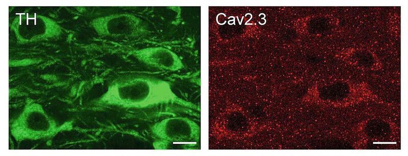 Antikörper-Färbung von Dopamin-produzierenden Nervenzellen der Maus (grün). Die Cav2.3 Kanal-Proteine in den Zellen sind rot gefärbt. Maßstab: 10 µm (Benkert et al., Nature Communications)