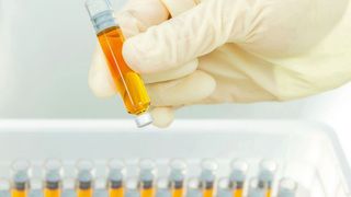 Karpulen aus Glas werden oft für die Abfüllung von Anästhetika in der Dentalanwendung verwendet. (Optima Pharma)