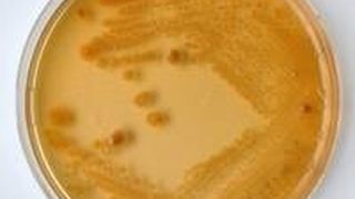 E-Coli-Kultur in einer Petrischale (Bild: HZI)