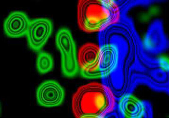Die Kernporen (rot) sind die Eingangspforten zum Zellkern, der die genetische Information (blau) enthält. Das Protein p75NTR (grün) macht diese Kernporen für bestimmte Moleküle durchlässig. (Bild: Akassoglou lab, Gladstone Institutes)