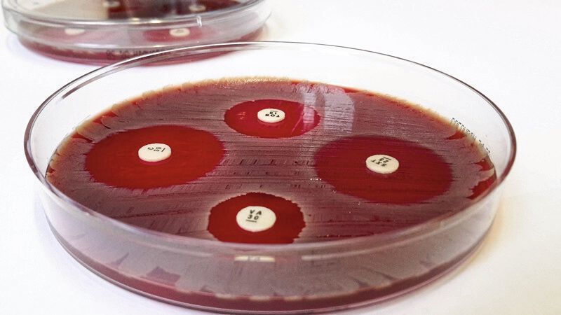 Der Agardiffusionstest macht Antibiotika-Resistenzen sichtbar. (DZIF/Fabian Grein)