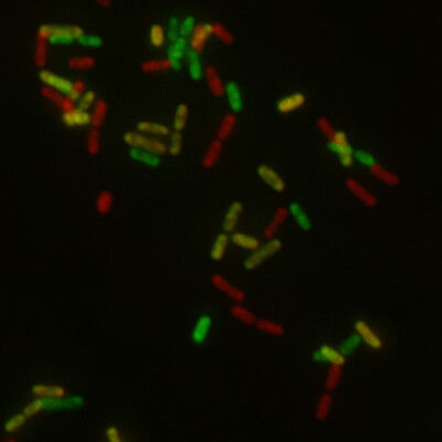 Bakterienzellen, deren ribosomale Untereinheiten farbig markiert sind. (Bild: Institut für Molekulare Mikrobiologie, Universität Konstanz)