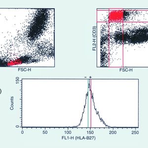 Schneller Nachweis Humaner Leukozyten Antigene