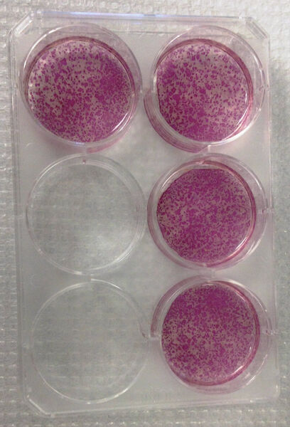Abb.4: Alkalische-Phosphatase-Färbung an Tag 28 der mittels Simplicon RNA-Reprogrammierungstechnologie reprogrammierten Fibroblasten (HFF und BJ). (Bild: Merck Millipore)