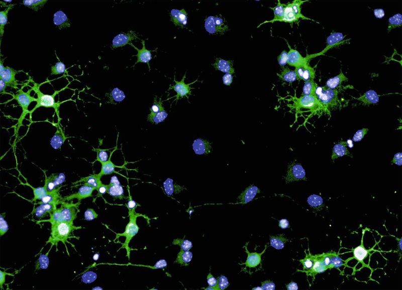 Myelin-Reparaturzellen (Oligodendrozyten) einer Maus in der Kulturschale. Sie stellen Myelin her (grün), das sie für die Reparatur der Nervenzell-Ummantelung verwenden. Zellkerne sind blau angefärbt. (Staroßom/Charité)