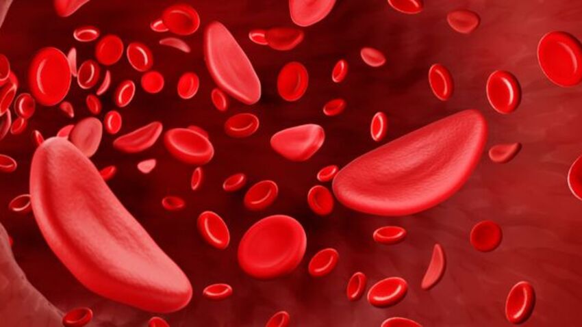 Die sonst sehr flexiblen roten Blutkörperchen werden bei Menschen mit Sichelzellkrankheit steif und nehmen bizarre Formen an, die an eine Sichel erinnern, was der Erkrankung ihren Namen verlieh. (Bild: Artur - stock.adobe.com)